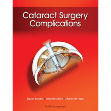 Cataract Surgery Complications by Lucio Buratto Hardcover Book