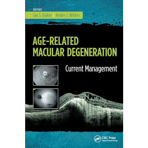 AgeRelated Macular Degeneration Current Management by Jay Duker Paperb