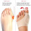 1 Pair Hallux Valgus Corrector Day Night, Large Toe Straightener 2