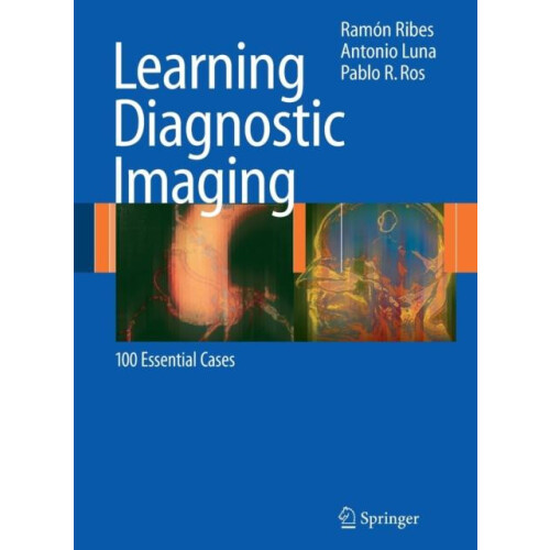 Learning Diagnostic Imaging 100 Essential Cases by Ramn Ribes Paperbac