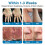 Kyno GFOUK Vein Repair Microneedle Patch Roll, 2026 GFOUK Vein Target Microneedl 2