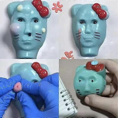 Παιχνίδι Pimple Popper Fidget με εργαλεία πλήρωσης, παιχνίδι ανακούφισης από το στρες 2