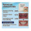 Glidewellpd Premium Silicone Denture - Smileasego Full Mouth Dentures 3