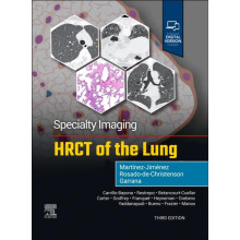 Specialty Imaging HRCT of the Lung by Garrana Sherief MD Clinical Assi