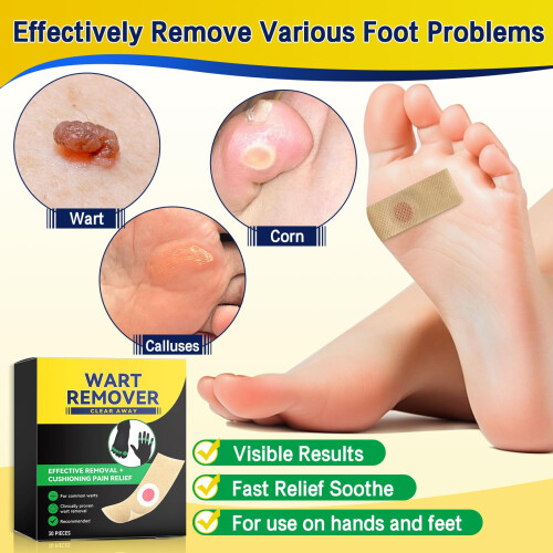 Wart Remover Plasters Patches Maximum Strength Verruca Corn Removal for Plantar 1