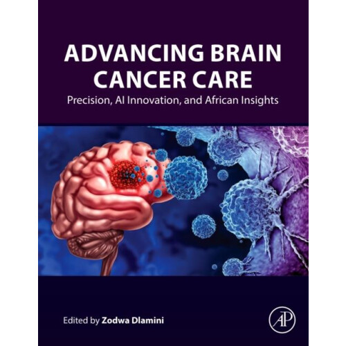 Advancing Brain Cancer Care Paperback Book