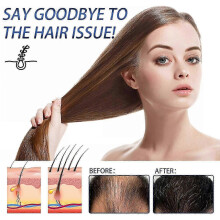 Regain Hair Spray - Moisturizing & Repairing Spray for Dry Hair, Strengthens Roots & Prevents Hair Loss