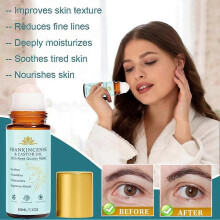 50ml Frankincense Castor Oil - Rollerball for Skin Elasticity & Sleep