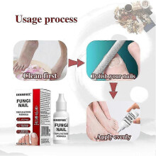 (2pcs) 15ml Fungi Nail Treatment Liquid Fast-Acting Nail Repair Strengthening Liquid Nails Care Supplies