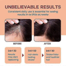 Raw Batana Oil for Hair Growth - 100% Pure, Organic Batana Oil for Thick and Strong, Prevent Hair Loss, Strengthenes & Repairs Dry, Damadge, 120ML