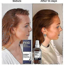 Hair Growth Spray To Prevent Hair Loss