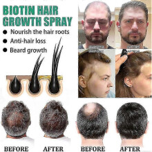Biotin Hair Growth Spray Anti Hair Loss Fast Regrowth Scalp Treatment Serum