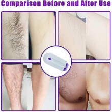 (For AU) Smooth Hair Eraser Laser, Silky Smooth Hair Eraser, Painless Hair Removal Tool, Women Laser Rechargeable Epilator Remover