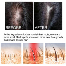 Dense Hair Growth Oil Nourishing Strengthening Essential Oil for Thicker, Longer Hair | Clogs Hair Follicles, Reduces Breakage, Promotes Healthy S