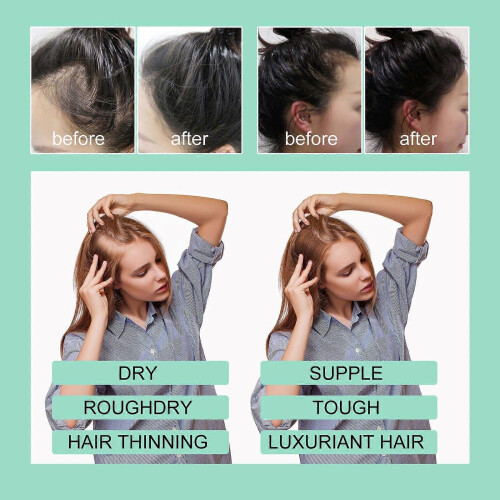 Rosemary Hair Care Essential Oil 2