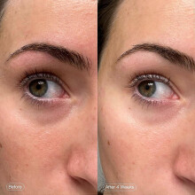 Topicals Faded Brightening Under Eye Masks | Patches to Depuff, Hydrate, Brighten and Cool | Reduce Dark Circles and Fine Lines | Contains Kojic
