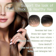 (4pcs) Hair Growth Oil 100ml Herbal Hair Oil Refreshing Non-greasy Oil For Nourishes Scalp And Stimulates