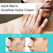 (2Pcs) Facial Care Cream, Adult Men's Acnefree Hydra Cream, Anti-pimple Facial Care Cream, Moisturizer Against pimples & Blackheads