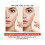 Pimple Patch  Hydrocolloid Plaster for Absorbing Acne Pimples 144Pcs Hydrocolloid Pimple Patch 1