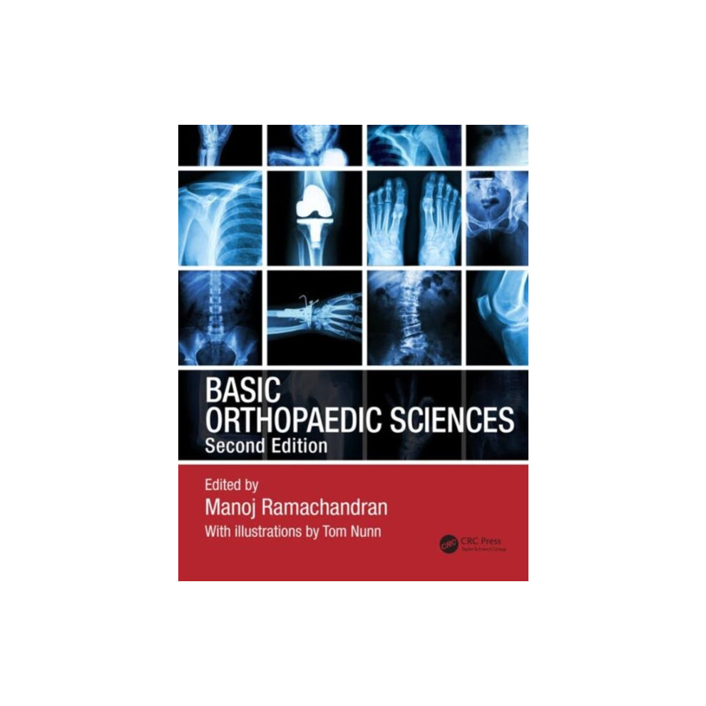 Basic Orthopaedic Sciences Paperback Book