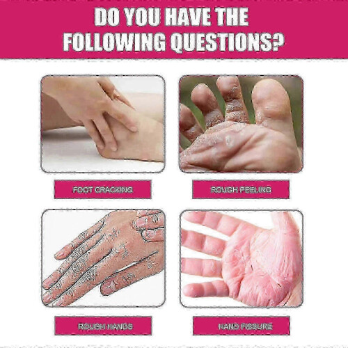 Moisturizing Gloves, Anti-Cracking Exfoliating Dead Skin Hand Moisturizing Protective Gloves