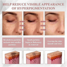 Blemish Peel off Gel Wrapping Mask,Blemish Peel off Gel