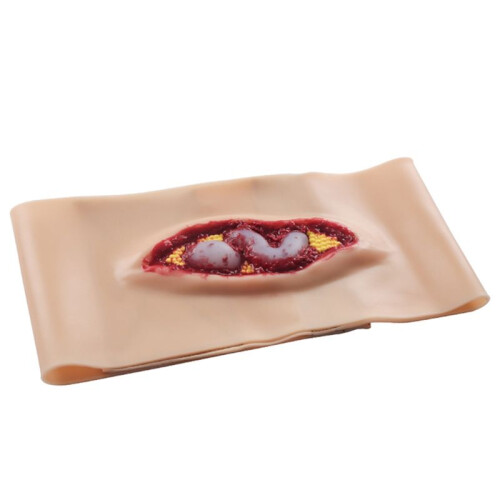 New Abdominal Anatomy Wound Training Model for Medical Teaching and Training, an Emergency Simulation Model Can Worn