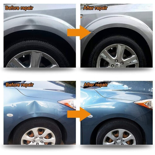 Manelord Auto Dent Puller Set with Double Pole Bridge Dent Repair Kit 1
