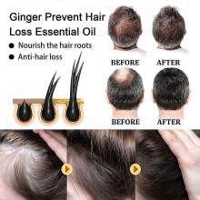 Ginger Hair Growth Oil for Thicker, Fuller Hair  Nourishing Scalp Massage & Volume Boost