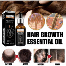 Hair Growth Essential Oil for Frizz Control & Repair - Nourishing Ginger, Aloe Vera & Castor, 30ml