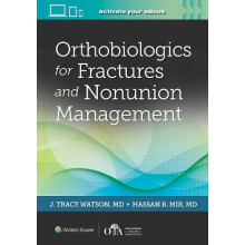 Orthobiologics for Fractures and Nonunion Management Hardcover Book