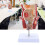 Human Rectum Model Human Anatomical Model Human Pathologies of Rectum Model 6