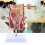 Human Rectum Model Human Anatomical Model Human Pathologies of Rectum Model 3