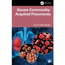 Severe CommunityAcquired Pneumonia by Gurmeet Singh Paperback Book