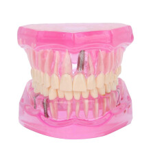 Modèle pédagogique dentaire transparent pour l'étude de la réparation pathologique des dents adultes et des implants mandibulaires