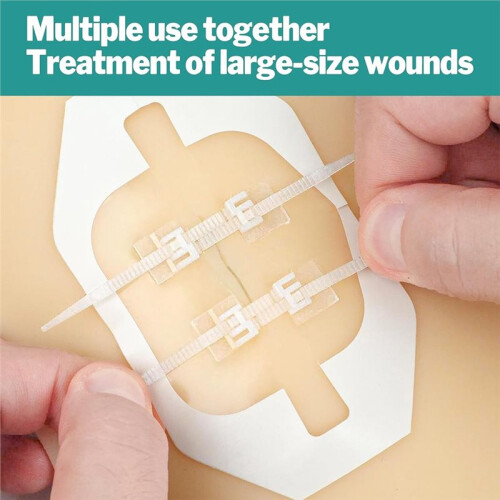 4pcs Butterfly Bandages, Emergency Wound Closure Strips Quick Clot Zip Device 2