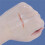 4pcs Butterfly Bandages, Emergency Wound Closure Strips Quick Clot Zip Device 5