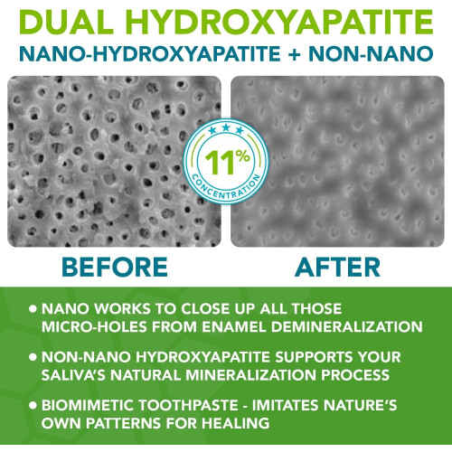 Nano hydroxyapatite Toothpaste Fluoride Free: Pro Remineralizing 2