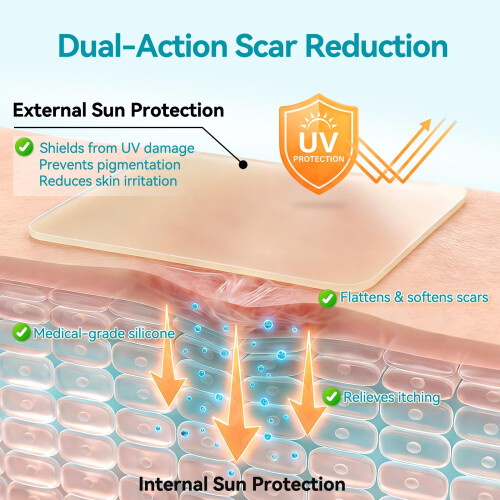 Dimora UPF50+ Silicone Scar Sheets with UV Protection Reusable Sheets 2