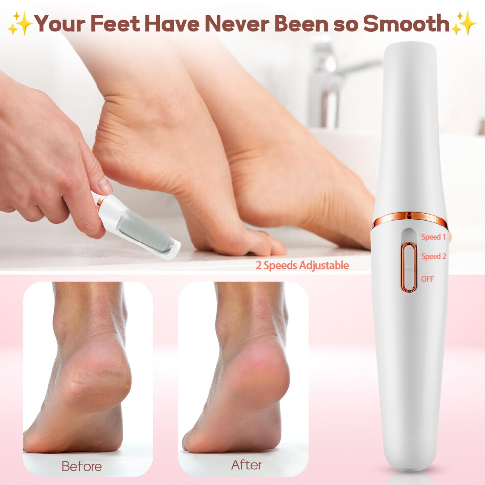 Zaboul Electric Callus Remover For Feet, Professional Rechargeable Foot File