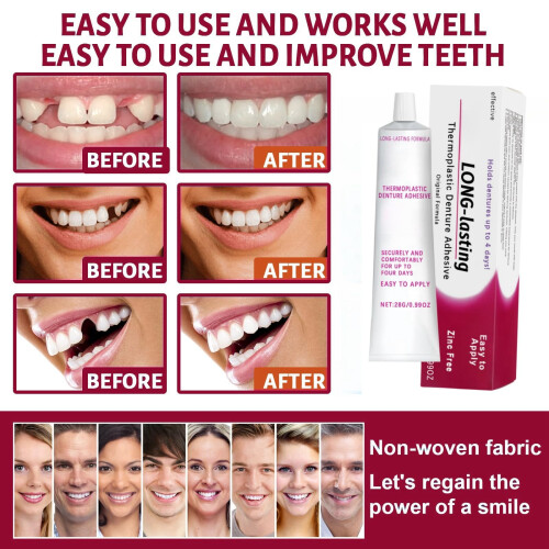 Thermoplastic Denture Adhesive,Denture Adhesive,Comfortable Non-Glue 1