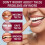 Thermoplastic Denture Adhesive,Denture Adhesive,Comfortable Non-Glue 4