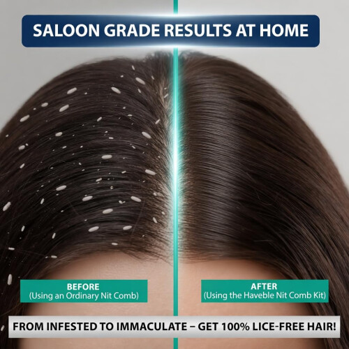 HAVEBLE Complete Nit Comb Kit | Removes Head Lice, Nits, Eggs, Fleas 2