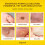 Fast-Acting Bee Venom Wart Remover: Verruca Treatment and Corn 5