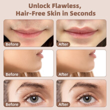 UQQU Facial Hair Remover for Women, Electric Lady Shaver & Epilator,