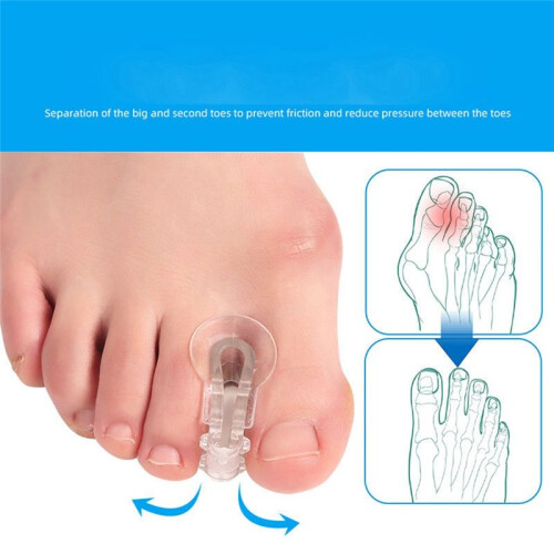 10 Pack Toe Spacers Separators, Bunion Corrector Gel Orthotics for Bunion, Overlapping Toes,Hallux Valgus 2