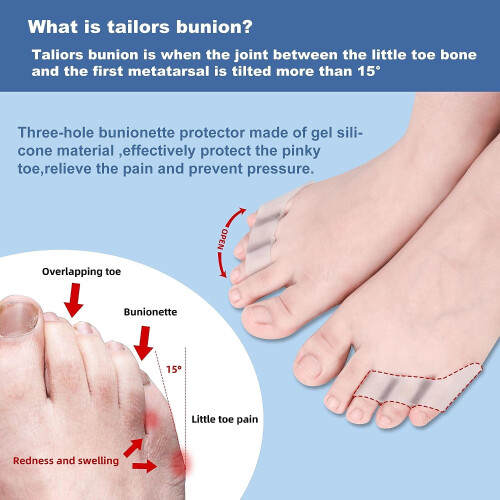 Διαχωριστικό Pinky Toe 6 τεμάχια Μαξιλάρι τζελ μαλακό διορθωτικό κάλων για 2