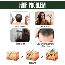 Ginger Hair Growth Spray  Nourishes Follicles, Prevents Hair Loss, Moisturizes  Thickens Hair  Natural Herbal Formula for Healthy, Strong, and Mana