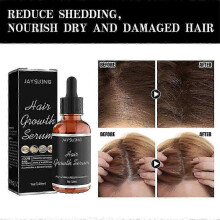 3pcs Ginger Extract Fast Hair Growth Loss Serum Essential Oil Anti Preventing Hair Loose Hair tonic Anti Hairline
