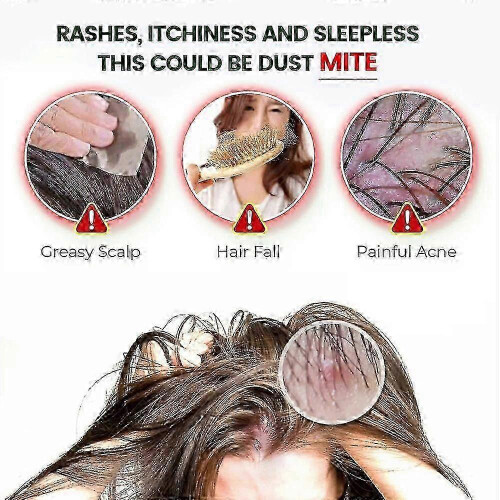 (5) Mite Removal Anti-itching Scabies Kill Lice Skin Care
